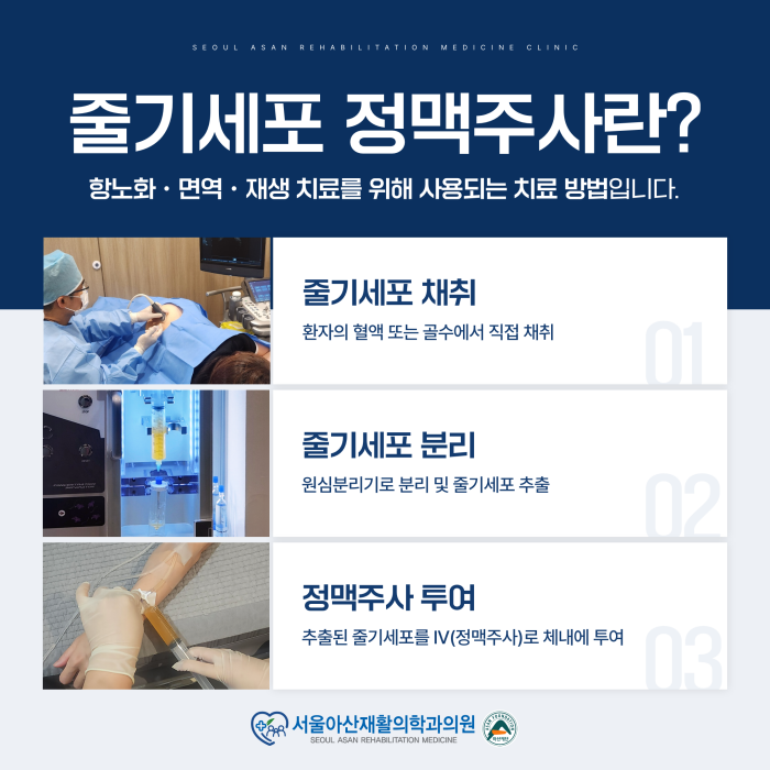 줄기세포 정맥주사