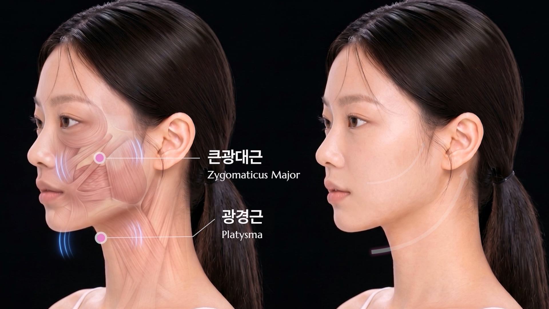 이중턱 생기는 이유 — 지방·피부·근육·부종, 원인별로 다르게 접근해야 하는 이유