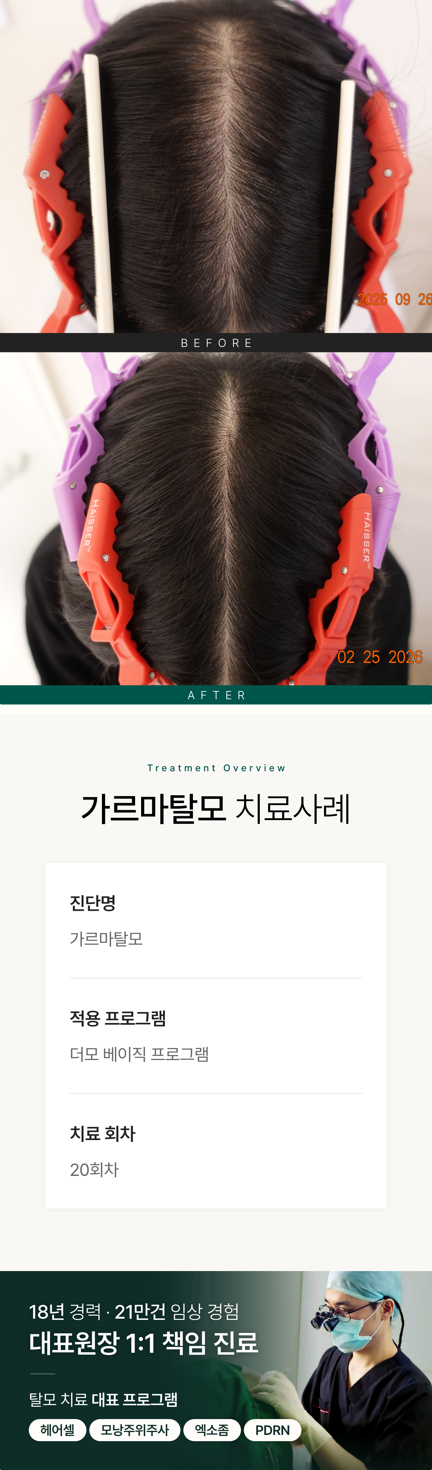 https://hospitals-media.s3.ap-northeast-2.amazonaws.com/dermoclinic/media/boards/2026/03/%EA%B0%80%EB%A5%B4%EB%A7%88_BA_05_Jl8Hz8G.png