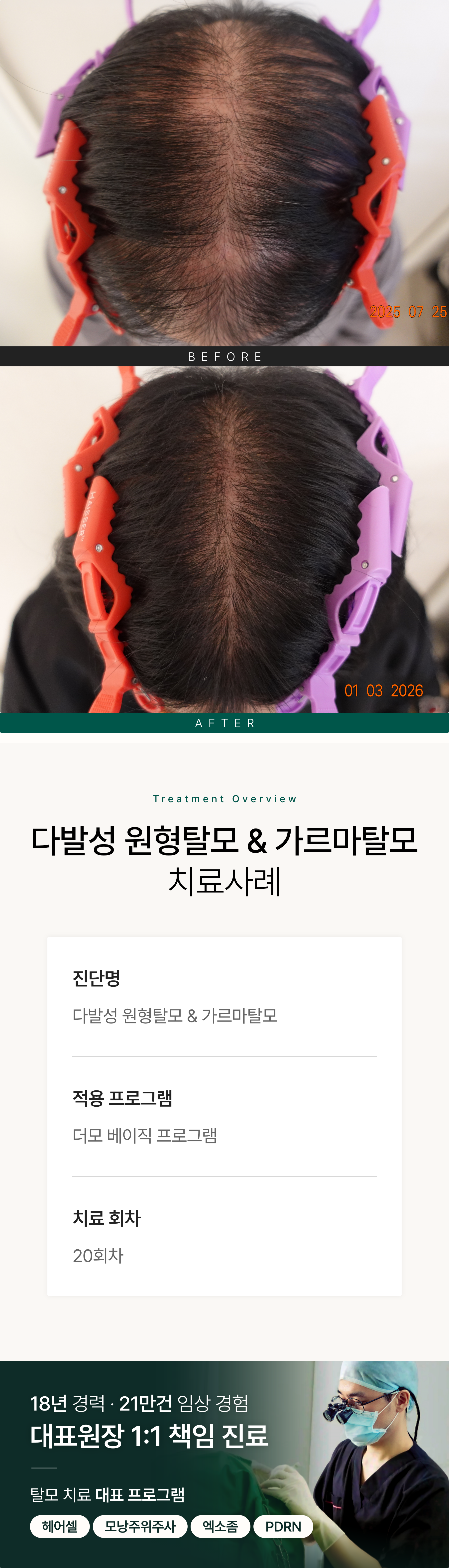 https://hospitals-media.s3.ap-northeast-2.amazonaws.com/dermoclinic/media/boards/2026/03/%EB%8B%A4%EB%B0%9C%EC%84%B1_%EC%9B%90%ED%98%95%ED%83%88%EB%AA%A8__%EA%B0%80%EB%A5%B4%EB%A7%88%ED%83%88%EB%AA%A8_BA_01_0hidhoQ.png
