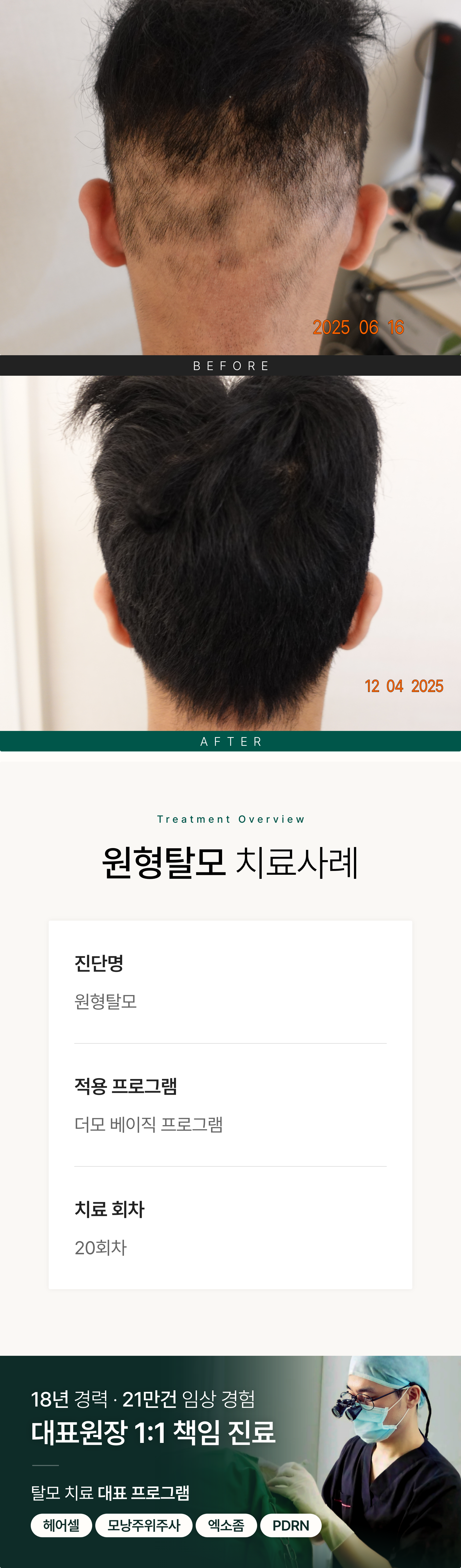 https://hospitals-media.s3.ap-northeast-2.amazonaws.com/dermoclinic/media/boards/2026/03/%EC%9B%90%ED%98%95%ED%83%88%EB%AA%A8_BA_01.png