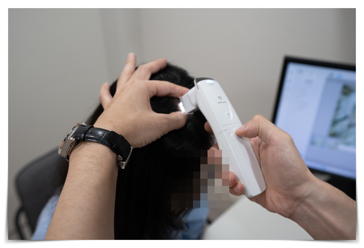 휴지기 탈모약 효과, 탈모약 효과