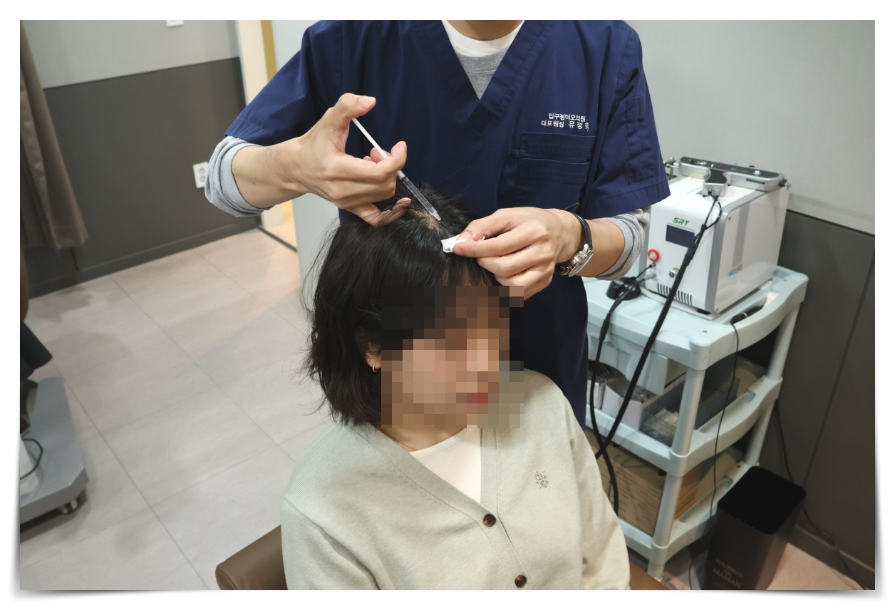 원형탈모 초기, 탈모 원인