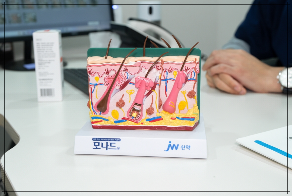 여자탈모치료 홈케어 방법 안내
