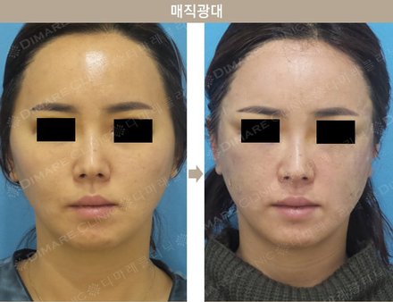 매직광대