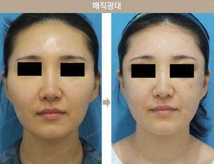 매직광대