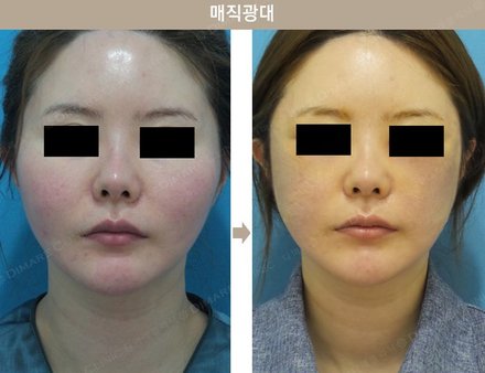 매직광대