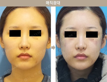 매직광대