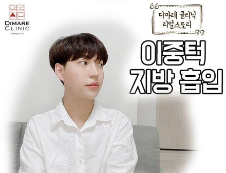 [디마레 리얼스토리] 남자 이중턱 지방흡입 리얼스토리