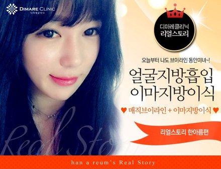 [디마레 리얼스토리] 아름이의 얼굴지방흡입(매직브이라인) + 이마지방이식 리얼스토리