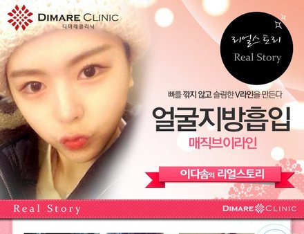 [디마레 리얼스토리] 다솜이의 매직 브이라인