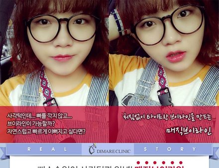 [디마레 리얼스토리] 보람이의 매직브이라인