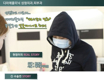 현졍이의 매직브이라인 리얼스토리