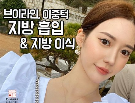 브이라인이랑 이중턱 지방흡입하고