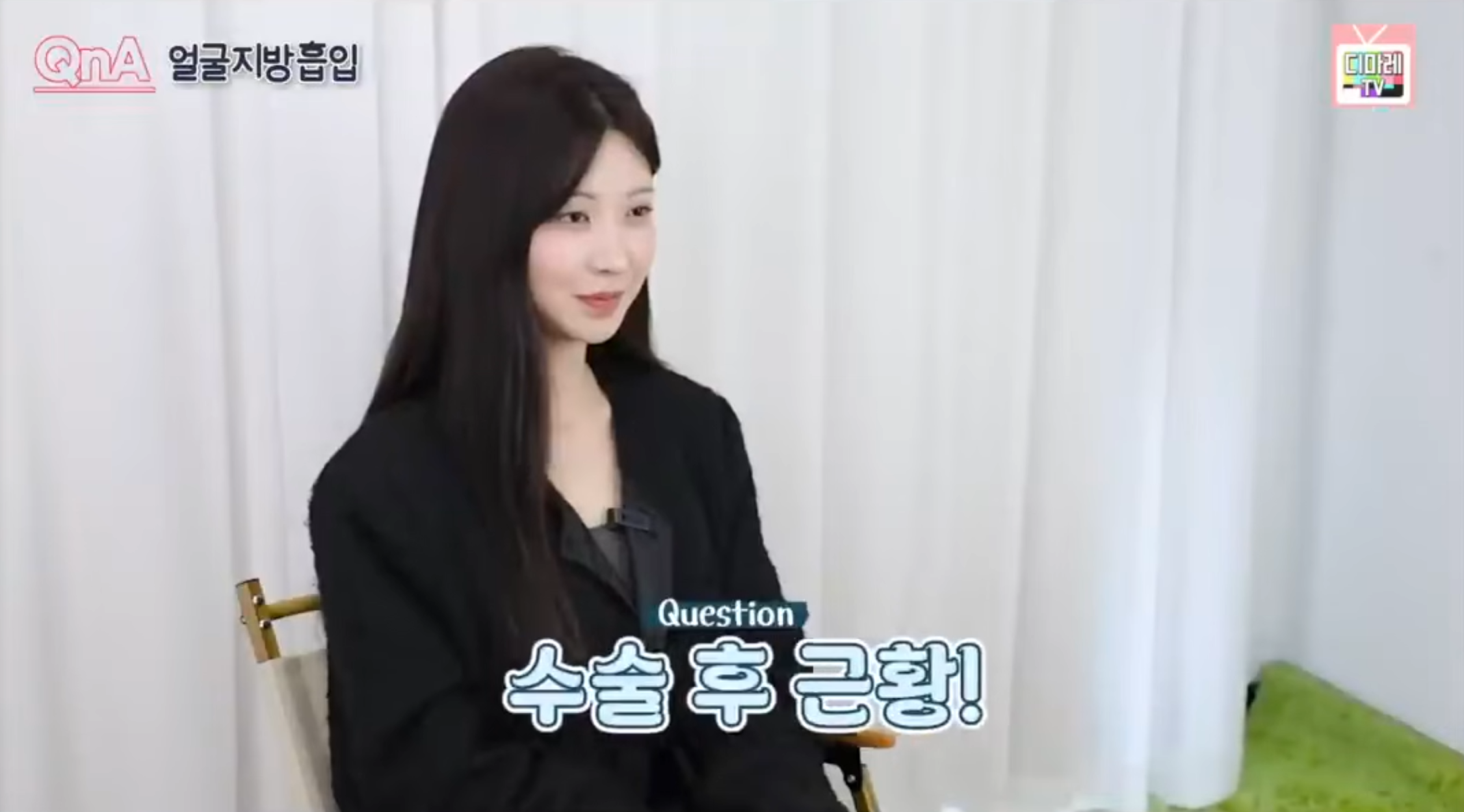 얼굴지방이식후기 디마레클리닉 수술 후 근황