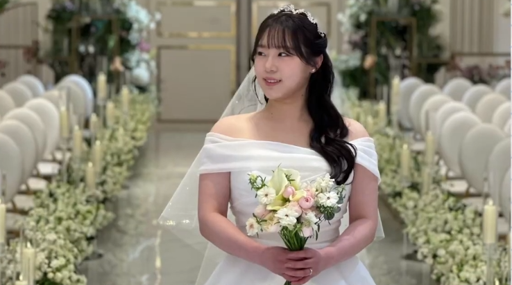 얼굴살빼는시술, 예비신부 지방흡입