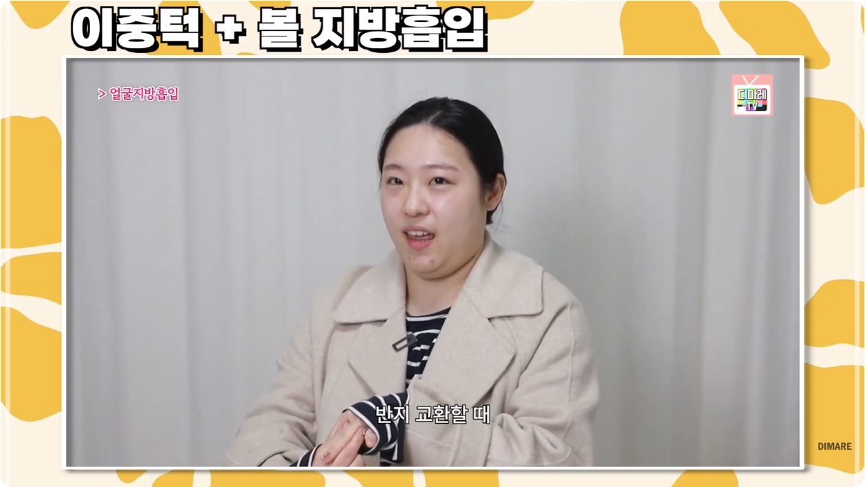 얼굴살빼는시술, 이중턱 볼 지방흡입