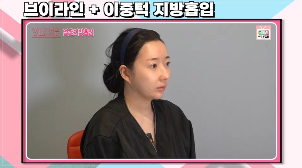 디마레클리닉 얼굴살 빼는법 지방흡입 전후