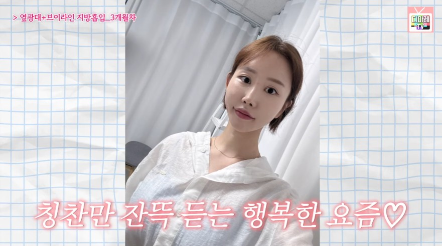 턱살 시술 3개월 후