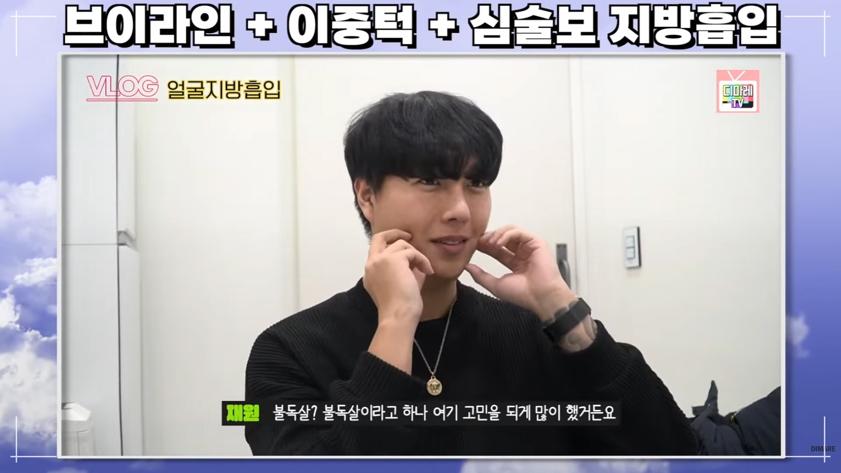 남자얼굴지방흡입을 고려하게 된 이유