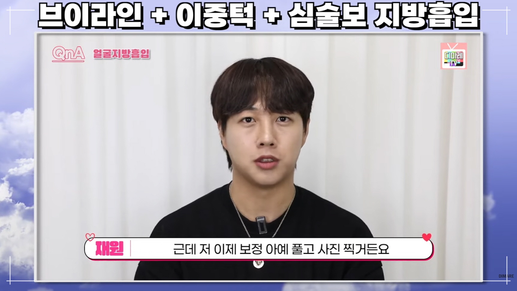 남자얼굴지방흡입 후 사진 찍을 때 보정이 필요 없다고 말하는 고객분