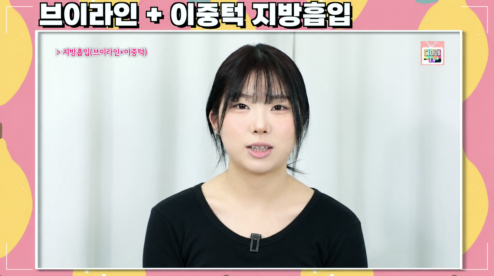 얼굴지방흡입 후기 디마레클리닉