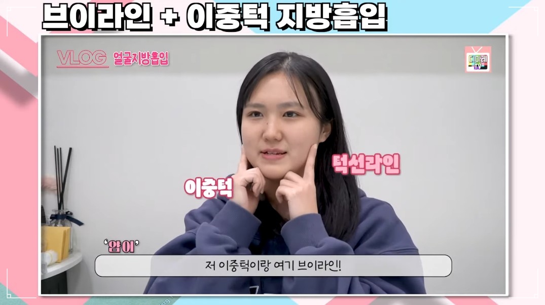 얼굴살만 안빠짐 얼굴지방흡입 전