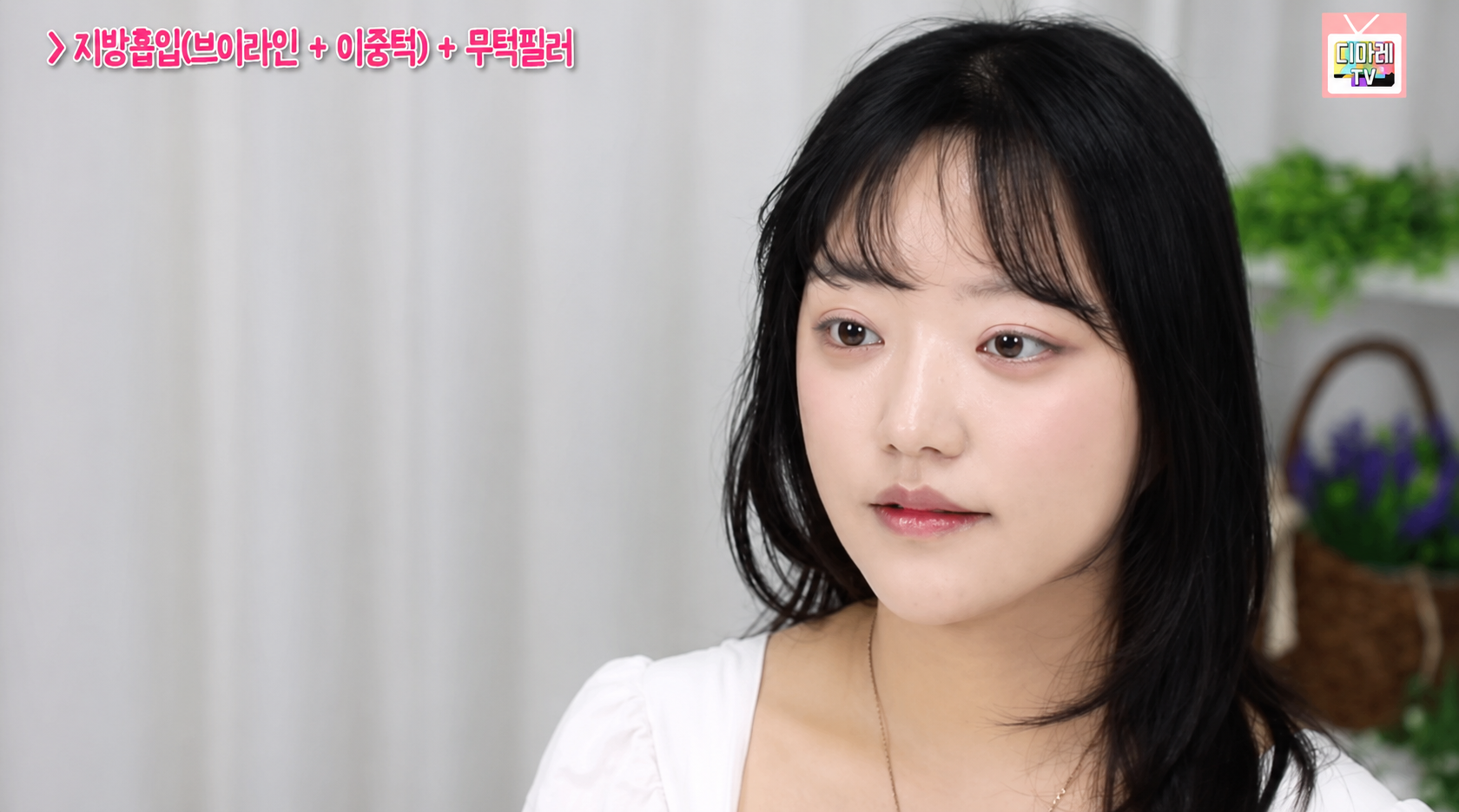 브이라인지방흡입 병원 찾는다면? 12kg 감량 후에도 남은 이중턱지방흡입 솔직 후기