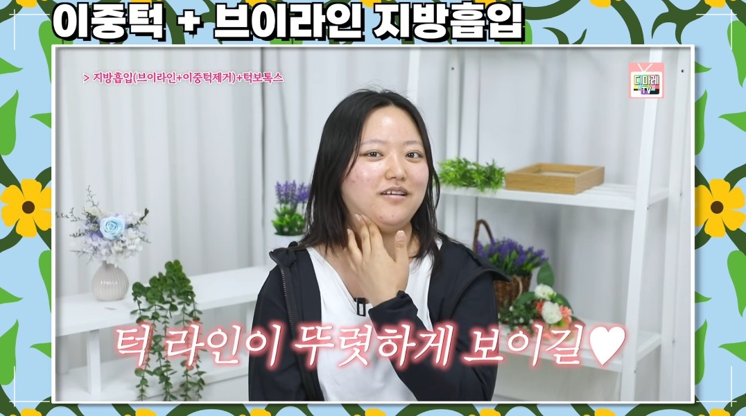 브이라인지방흡입 병원 찾는다면? 12kg 감량 후에도 남은 이중턱지방흡입 솔직 후기