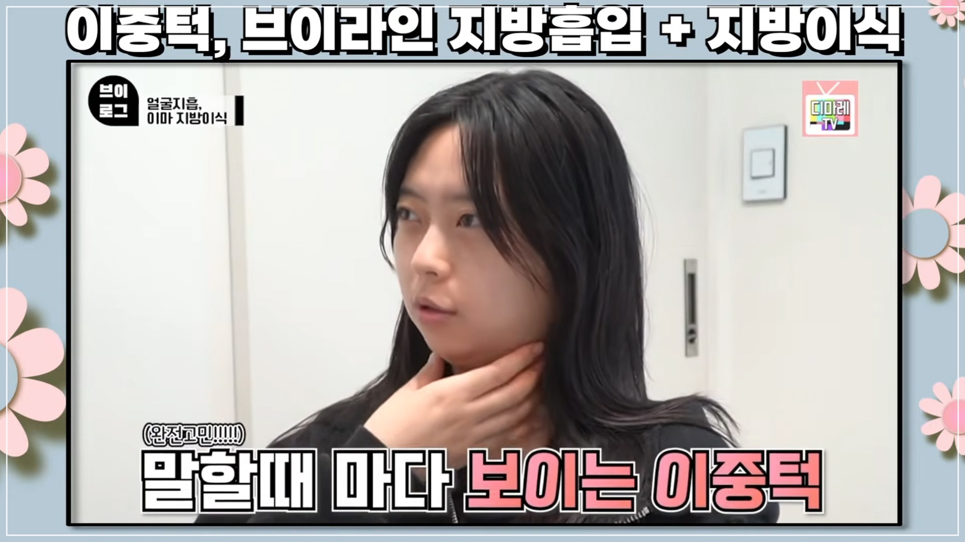 꺼진 이마 시술, 무턱 시술 추천 찾아보고 오신 환자분 이중턱 고민