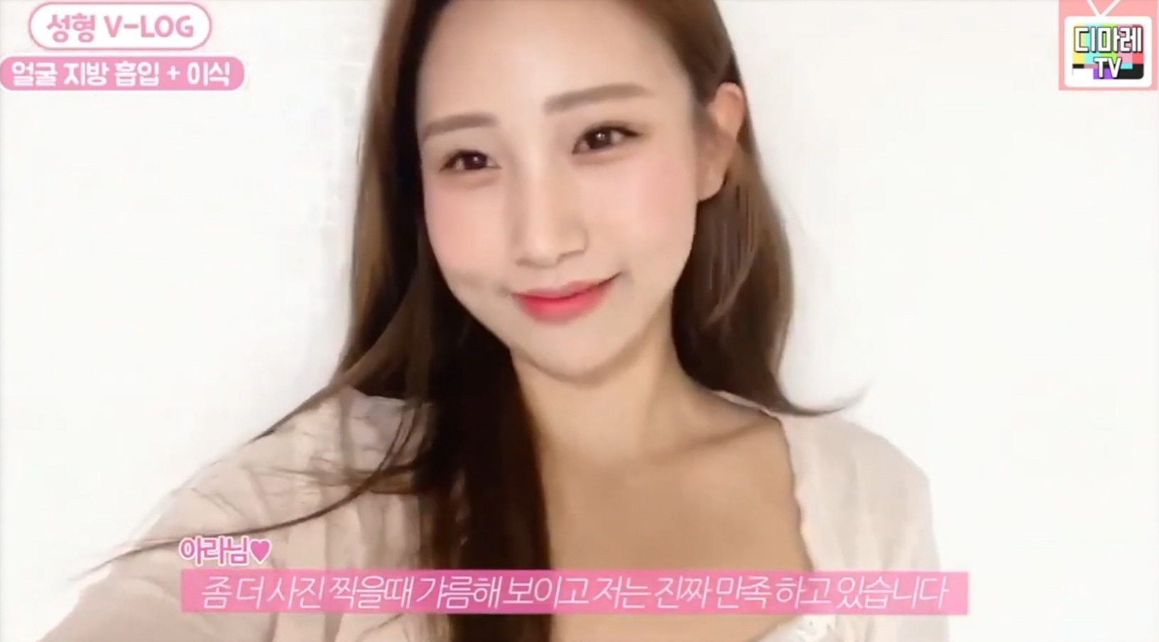 디마레클리닉 치료 후 변화
