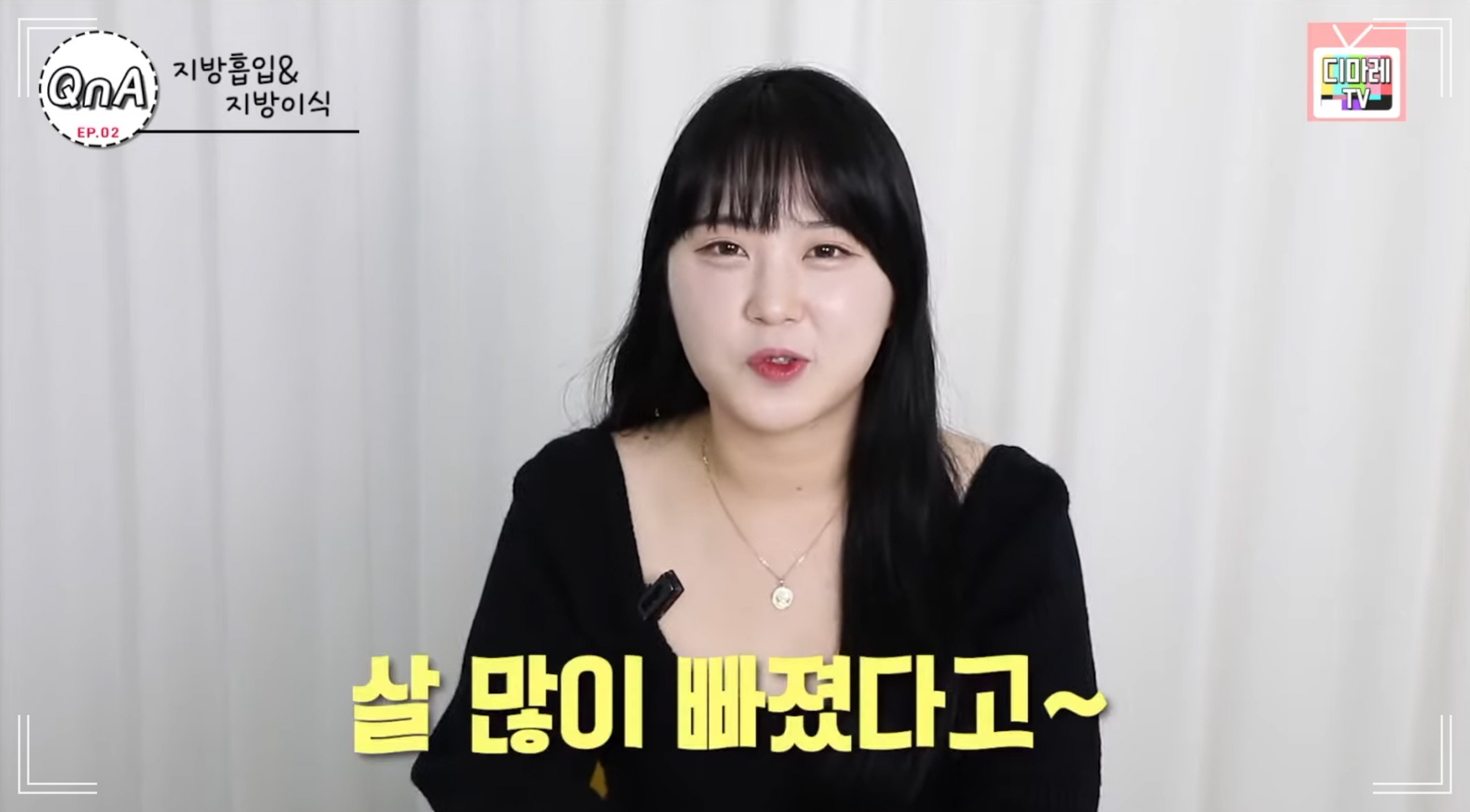 얼굴 작아지는 수술, 안면윤곽 볼처짐 우려 없이 이중턱 개선한 분의 인터뷰 사진
