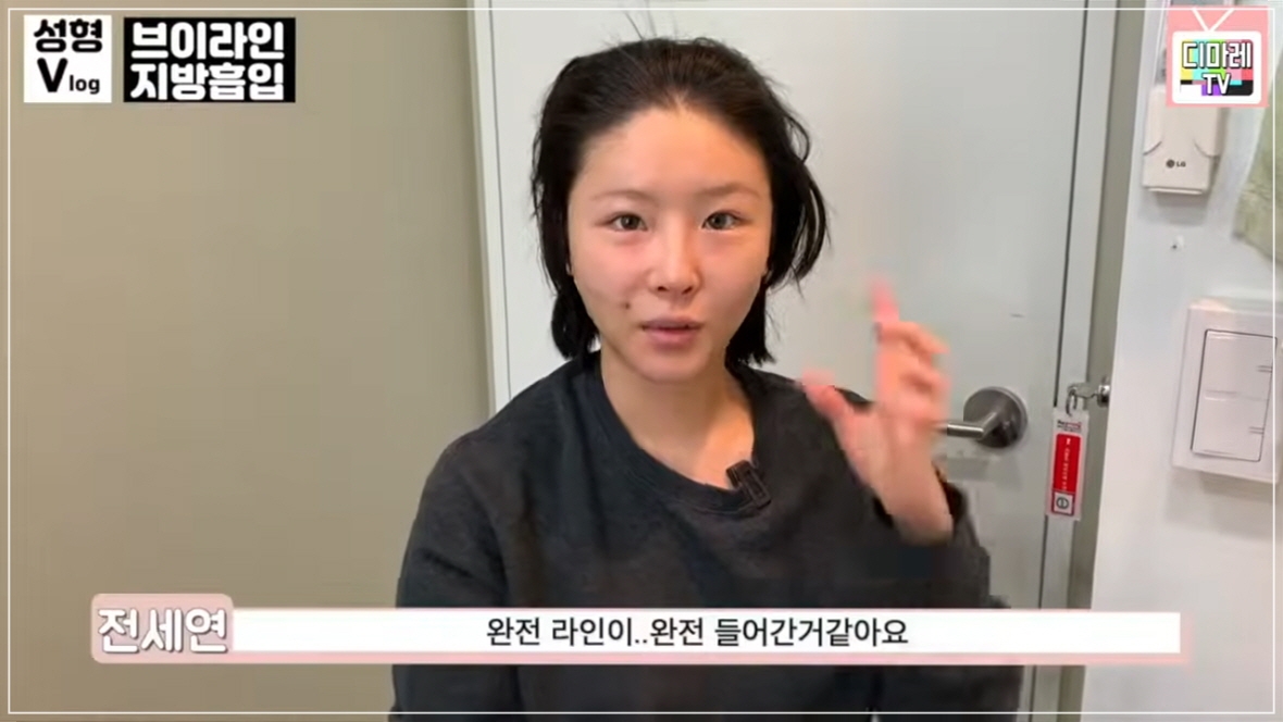 얼굴 볼살 시술 얼굴지방흡입