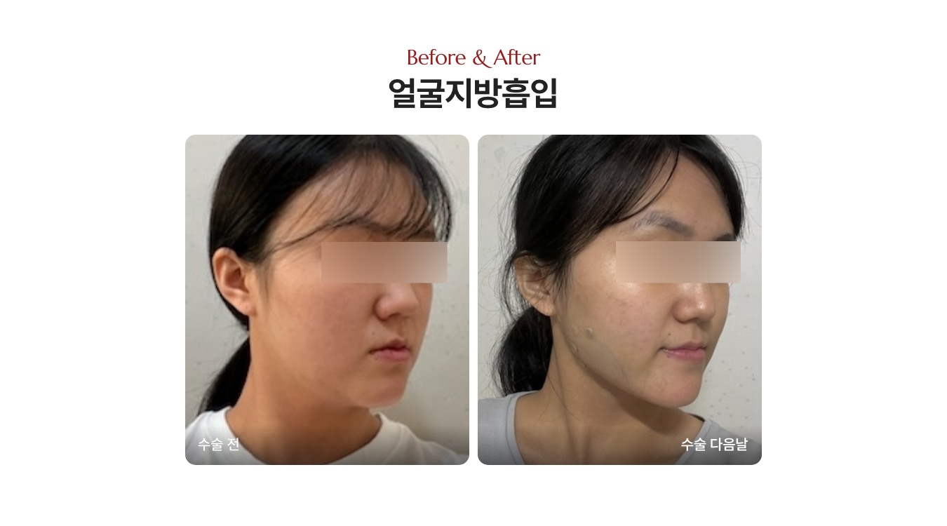 이중턱 시술 (병원), 디마레클리닉 이하영 원장