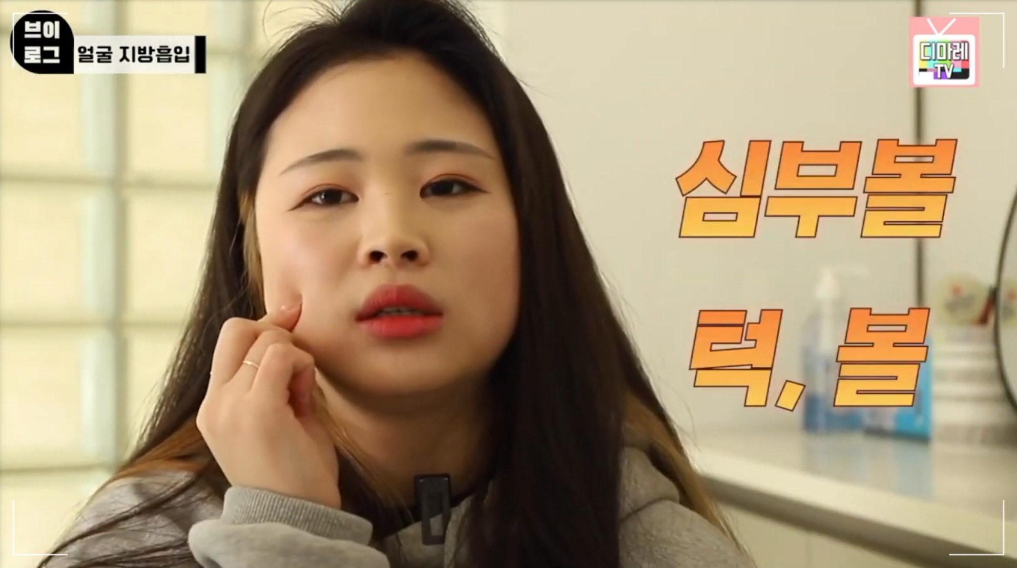 심술보 제거로 매끄러운 얼굴라인 정리한 환자분의 고민 부위 디마레클리닉 인터뷰