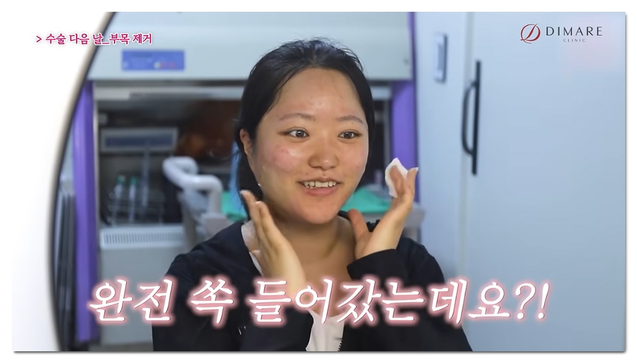 턱선 만들기, 턱살 원인