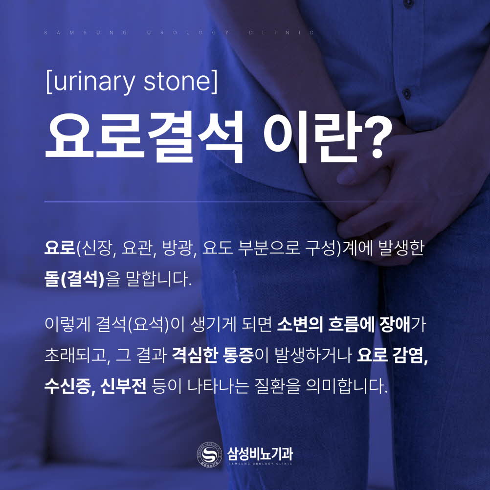 요로결석에 대해 설명하는 이미지